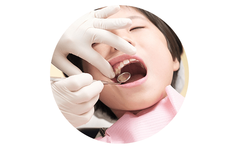 虫歯検診